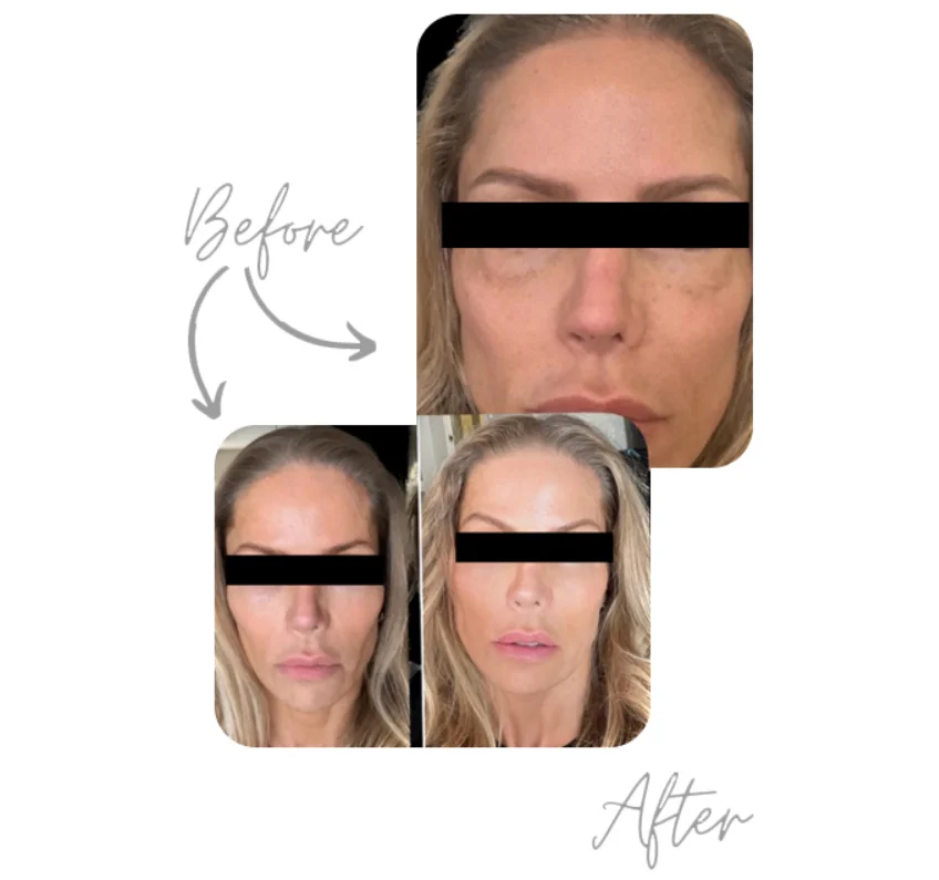 JCbefore and after